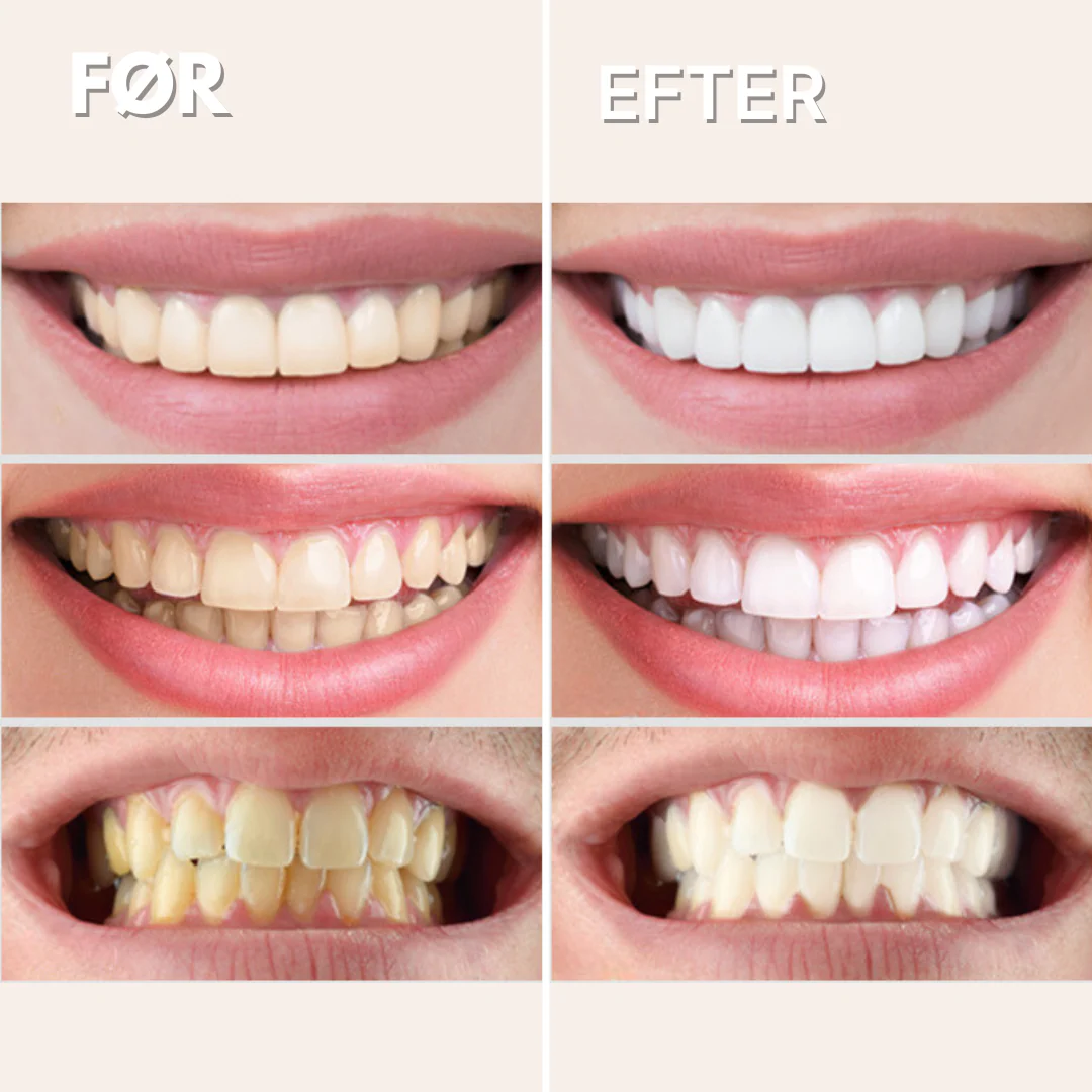 GlorySmile™ V34 Blegende Tandpasta (30 ml) - Image 6