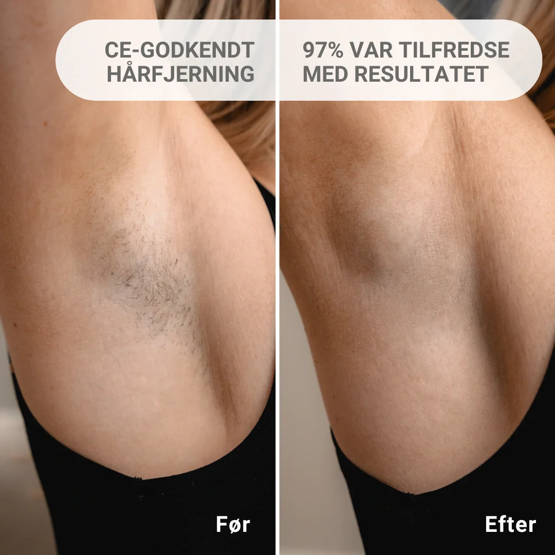 IPL & Scrub (PAKKETILBUD) - Image 6