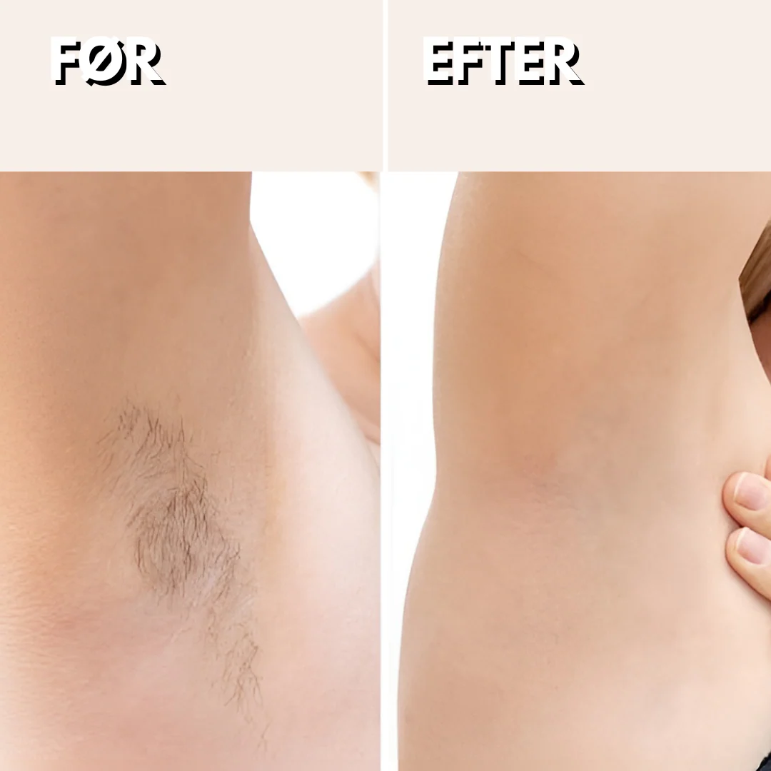 SilkTouch™ Barbermaskine - Let Præcision for et Fejlfrit Udseende - Image 4